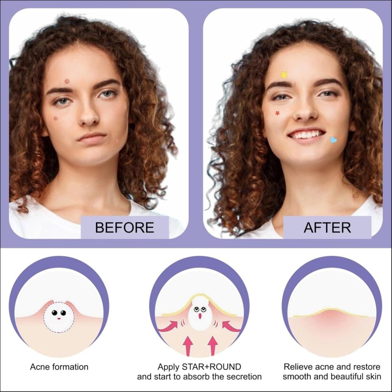 OG Korean GlamDots™