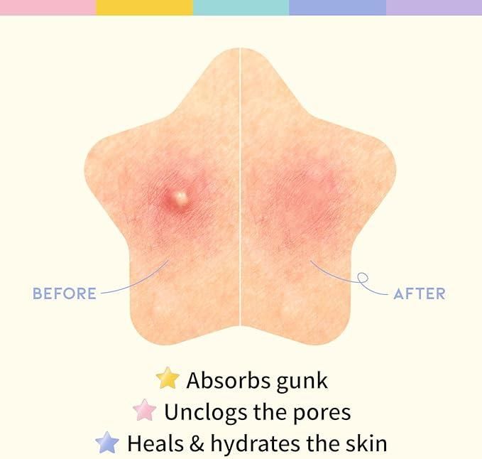 OG Korean GlamDots™